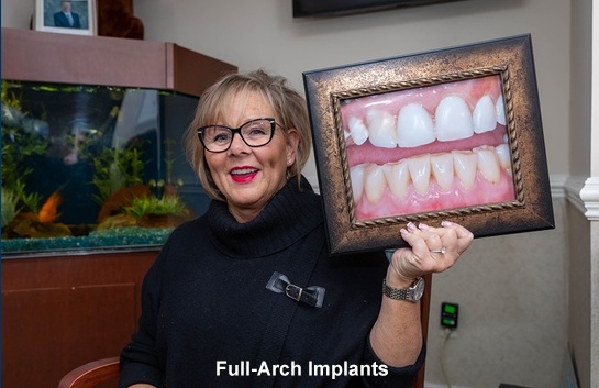 full-arch-implant-gallery
