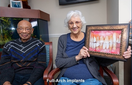 full-arch-implants-gallery (1)